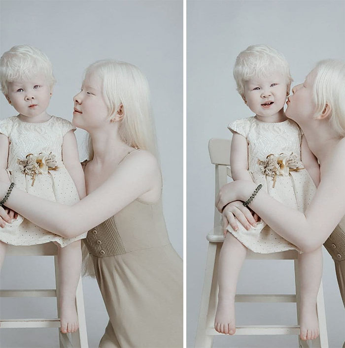 Despite being born over a decade apart, these siblings share a unique bond. The remarkable beauty of two albino sisters born 12 years apart astounds the world.