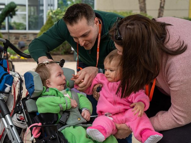 For the First Time, a Girl Meets Her 11-Month-Old Identical Twin Sister Born with a Rare Condition: ‘Extremely Emotional.’