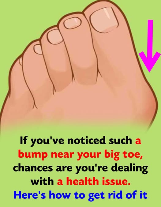 Coping with the Annoying Bump on Your Foot