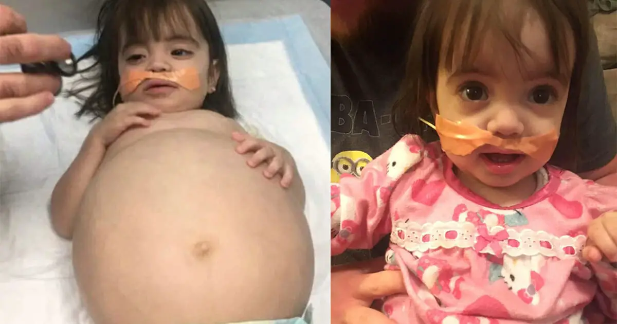 Baby girl receives life-saving kidney from her father after devastating diagnosis