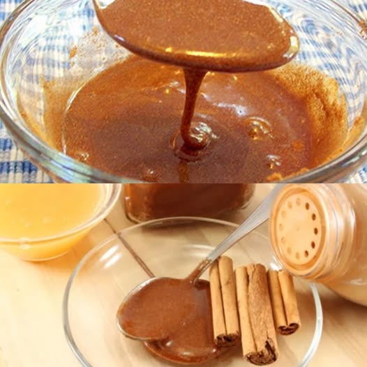 How to Prepare and Use the Honey-Cinnamon Mixture