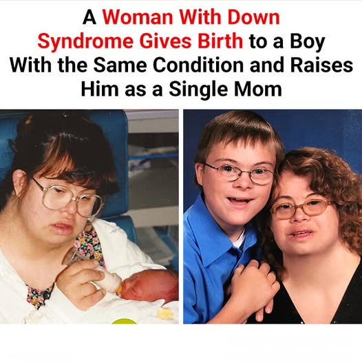 A Woman With Down Syndrome Raises Son With Down Syndrome As A Single Mom