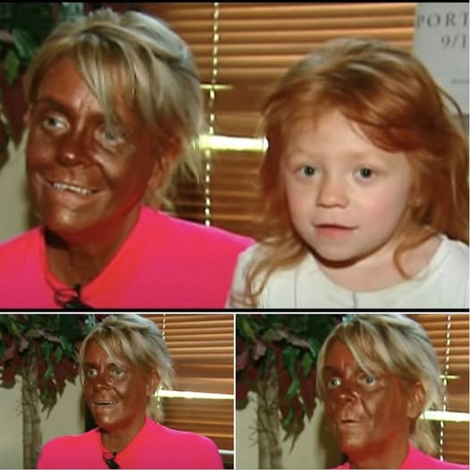 Mom-of-5 obsessed with tanning was accused of “burning” her 6-year-old in a tanning booth