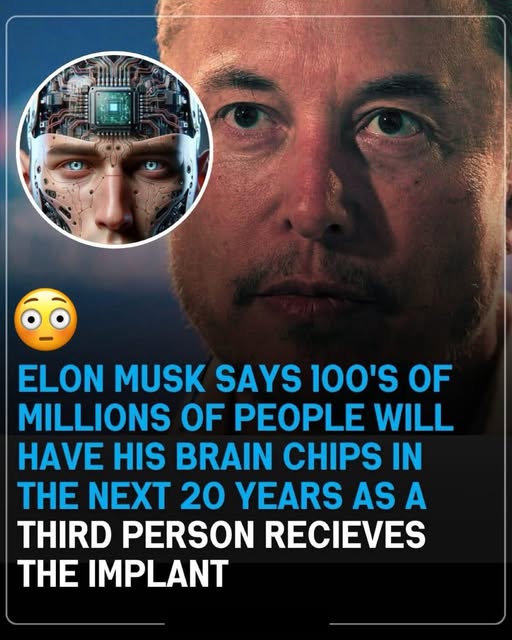 In 2024, Elon Musk Predicted ‘Hundreds of Millions’ Would Have His Brain Chips Within 20 Years—Remember This