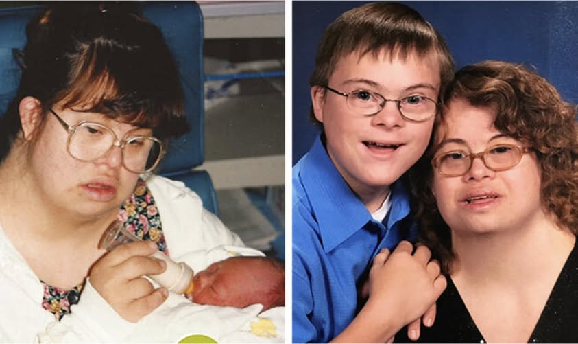 Couple with Down Syndrome Choose Parenthood, Overcome Criticism