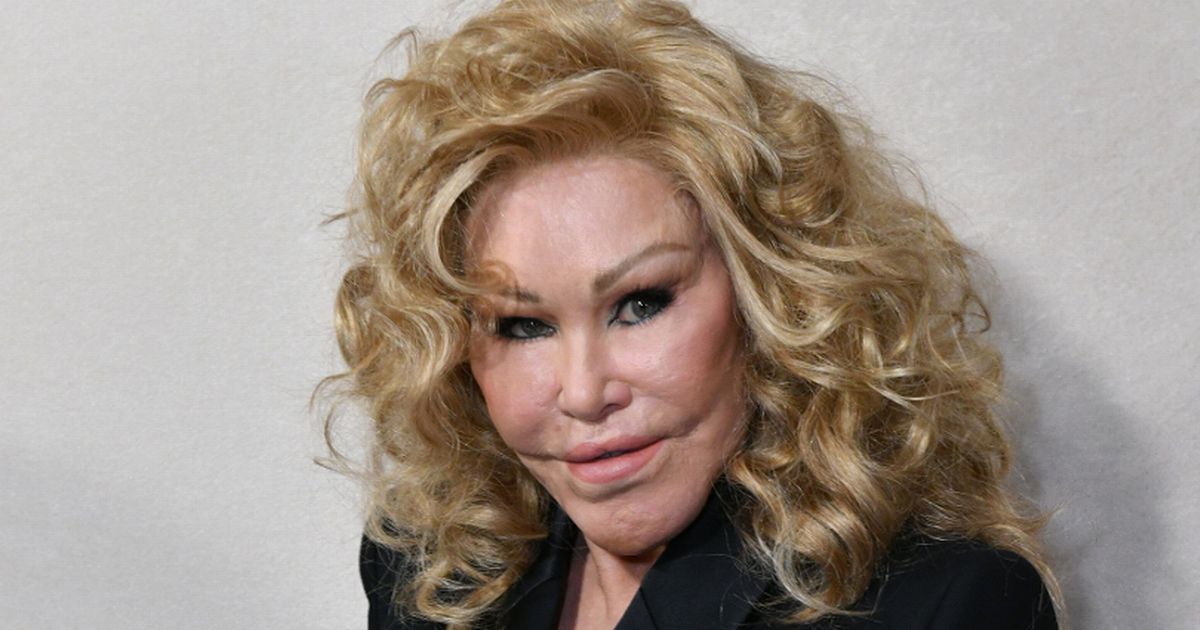 ‘Catwoman’ Jocelyn Wildenstein’s Real Face Before Plastic Surgery Uncovered