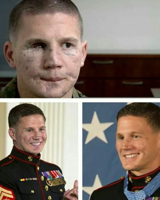 I HID MY FACE FOR YEARS—UNTIL THE DAY THEY HANDED ME THAT MEDAL