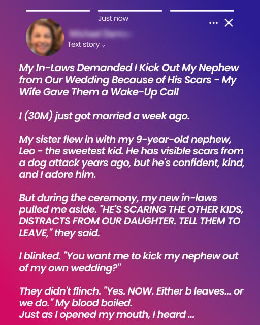 My In-Laws Demanded I Kick Out My Nephew from Our Wedding Because of His Scars – My Wife Gave Them a Wake-Up Call