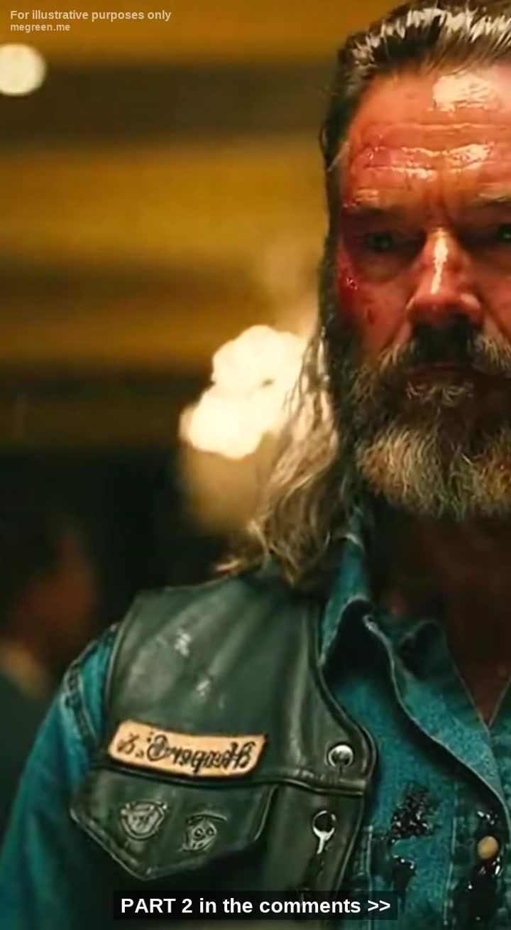 He Thought His $5,000 Suit Gave Him The Right To Burn A Veteran’S Face