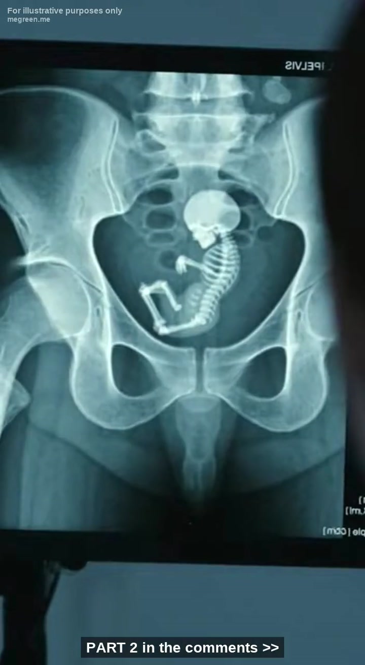 I Was Ready To Sign The Psych Papers