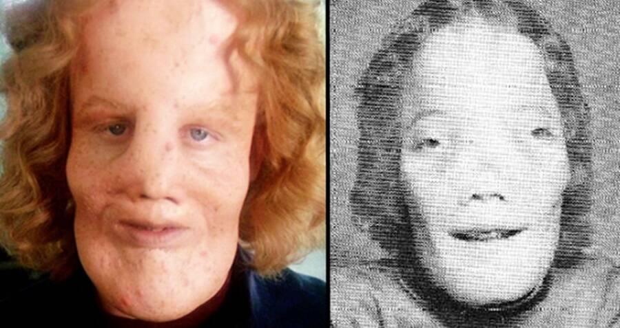 Rocky Dennis: The true story of the boy who inspired ‘Mask’