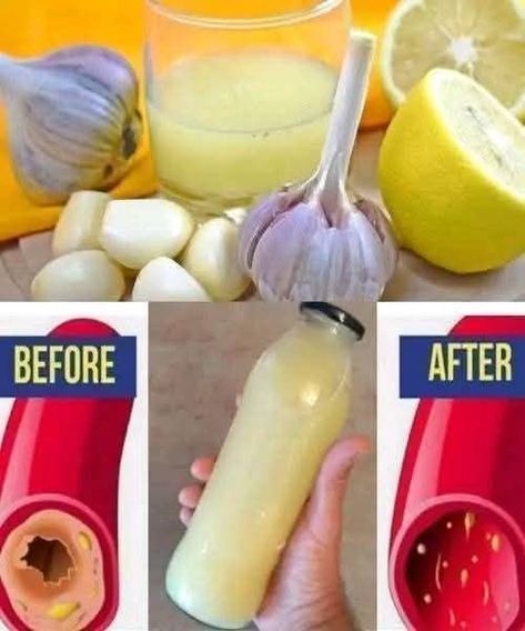 All Toxins and Parasites Will Come Out of Your Body! My Grandfather’s Old Recipe