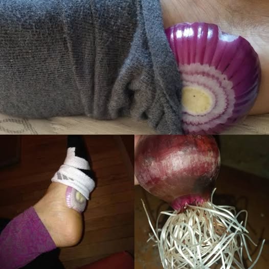 The Overnight Onion Hack: Understanding the Traditional Ritual