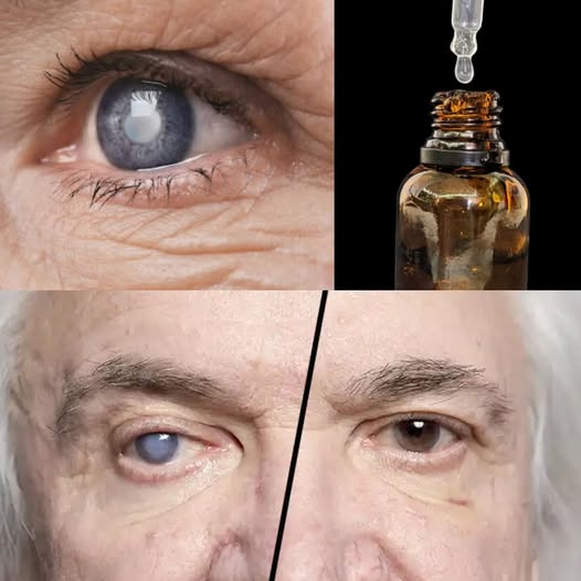 It Kills Cataracts, Restores Vision, and Relieves Eye Inflammation – Rosemary Oil