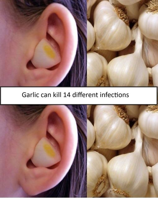 Garlic can kill 14 different infections I bet you didnโt know about.