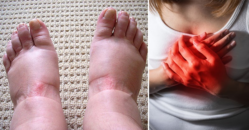 Swollen Feet? 9 Warning Signs You Should Never Ignore