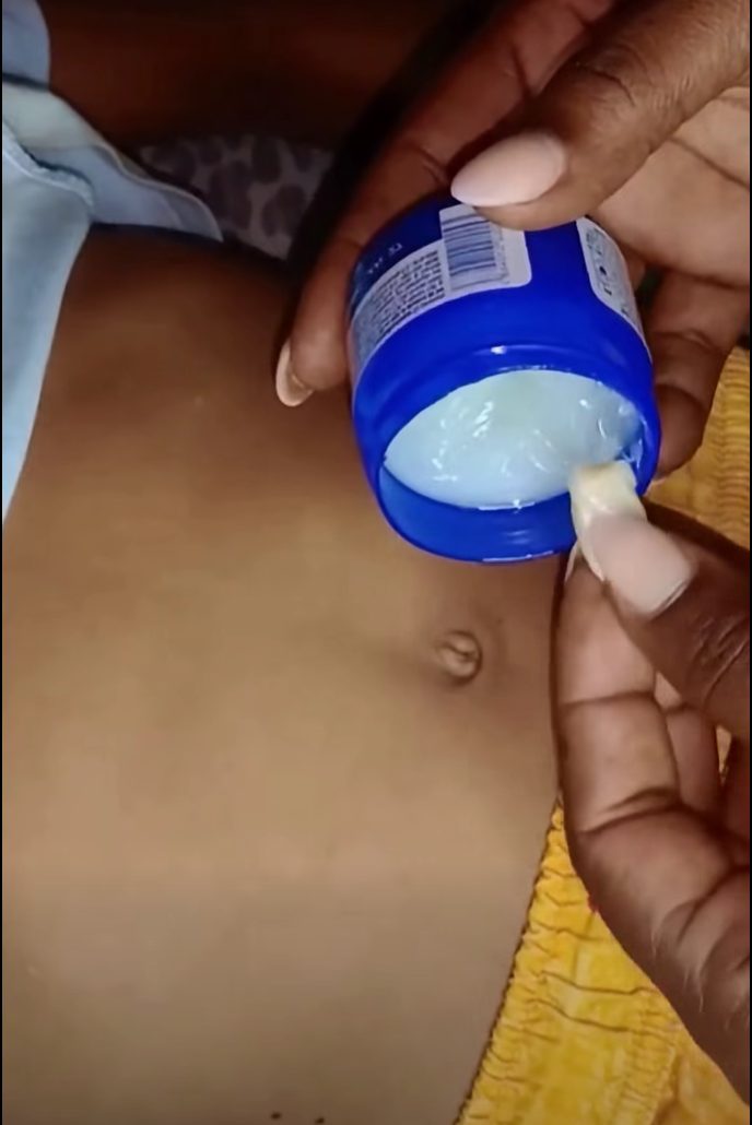 The Navel “Garlic Patch”: Understanding this Traditional Folk Remedy
