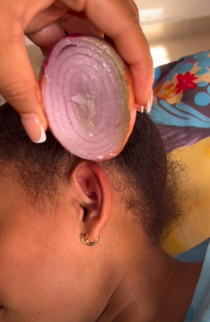 Red Onion for Ear Comfort – A Simple Old-Fashioned Remedy That Provides Gentle Relief