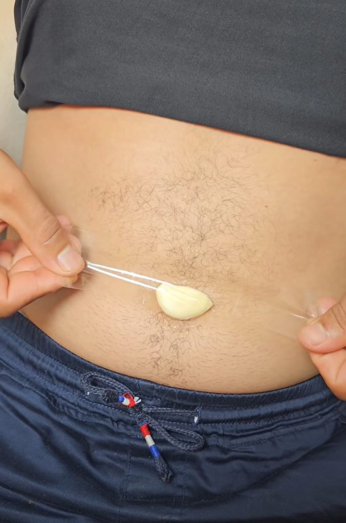 Garlic Clove and Menthol Rub on the Navel – A Simple Home Remedy for Back Pain, Joints & Cramps