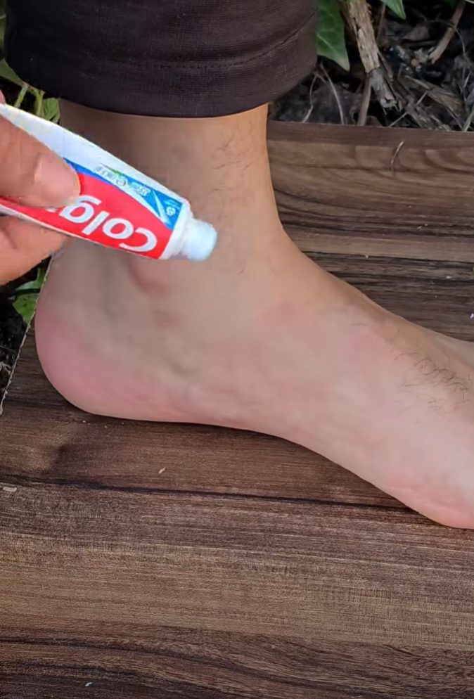 She Rubbed This White Paste on Her Ankles Every Night – The Swelling Vanished in 3 Days