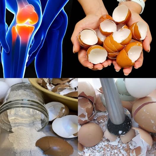 My Mother Could Not Walk Because of Pain in Her Knees and Bones – Until She Tried This