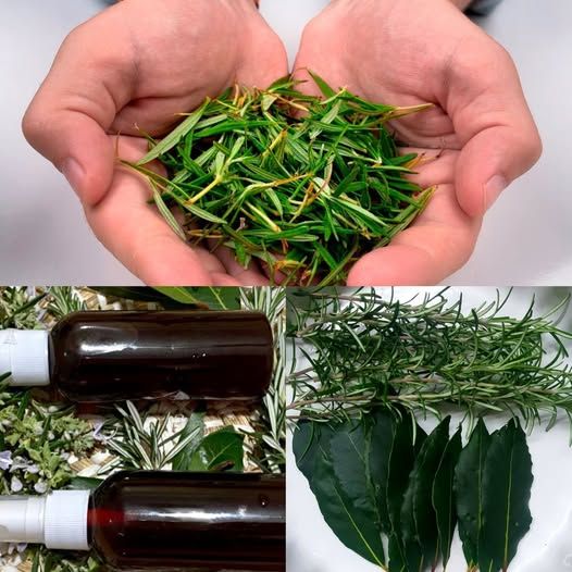 My Mother Could Not Walk Because of the Pain of Varicose Veins — Until She Accepted This Simple Remedy