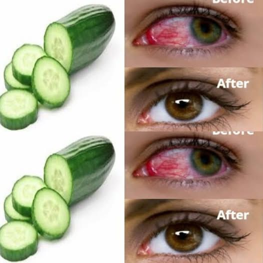 1 Spoon a Day for Stronger Vision – You Will See Far Objects Clearly