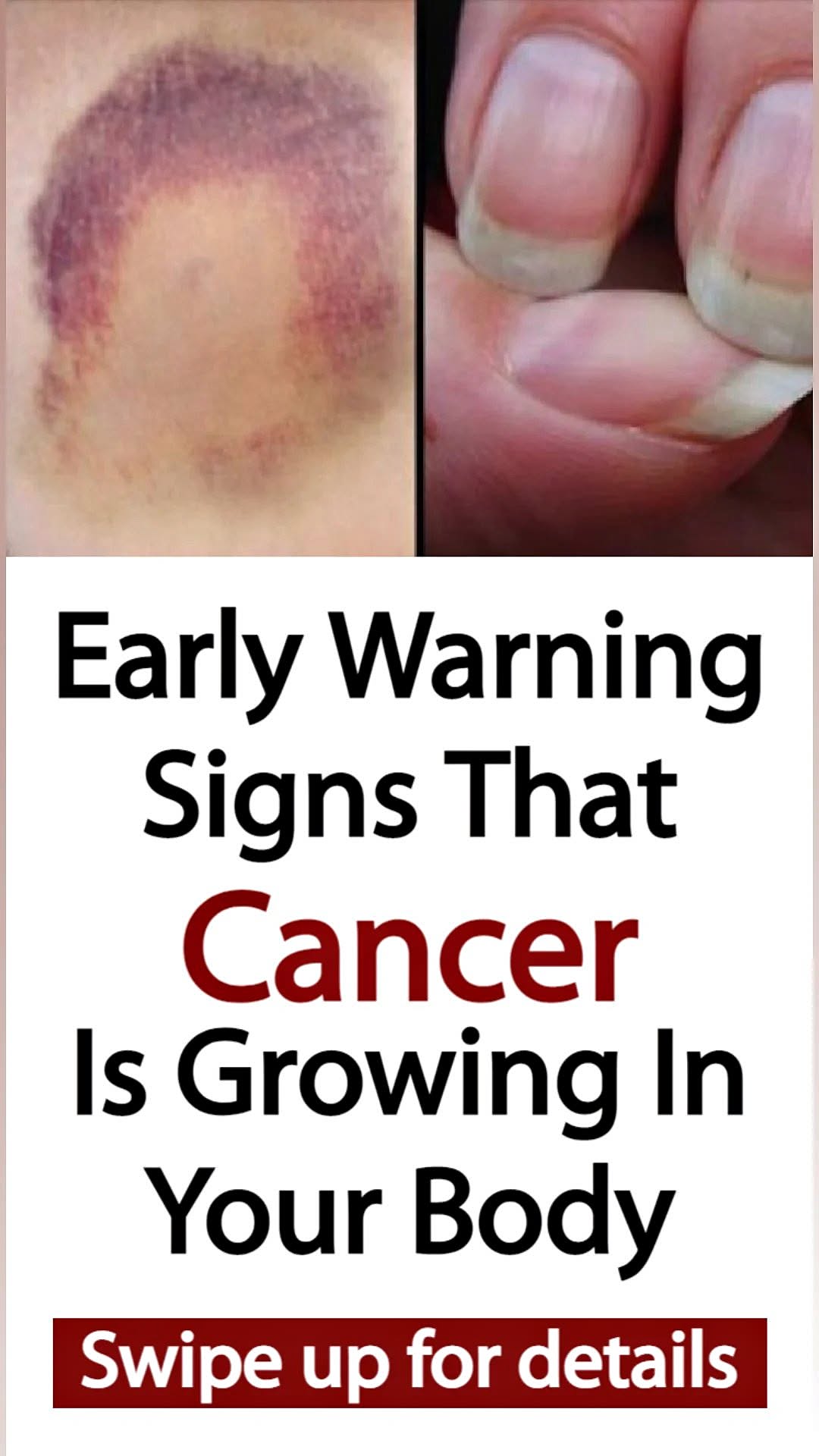 Early Warning Signs That Cancer Is Growing In Your Body