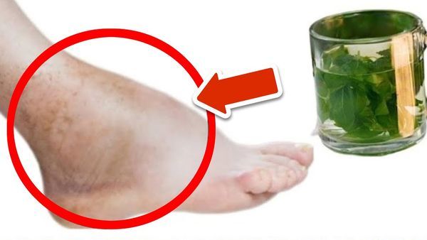 This Tea Removes Swelling in the Feet and Legs Forever 🤯💥