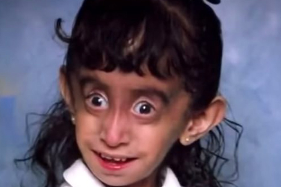 The story of Lizzie Velásquez – this is her today in 2026