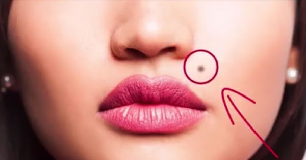 What It Means If You Have a Mole in These 7 Places on Your Body
