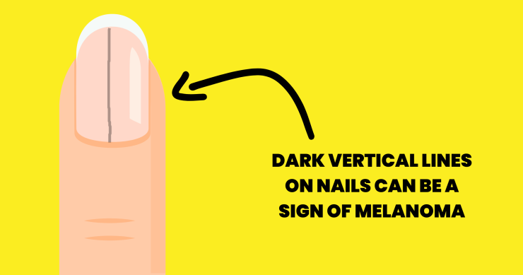 10 Everyday Signs Your Body May Need Attention