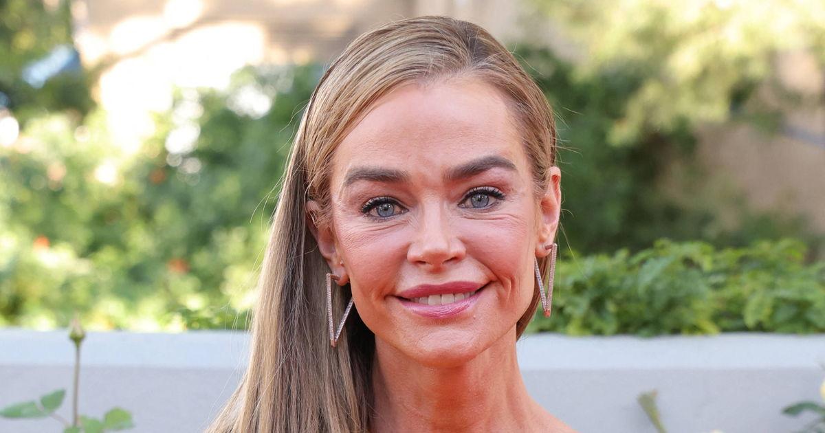 Denise Richards Shows Her Refreshed Look After ‘Terrifying’ Surgeries — And Why She Says It Was the Best Choice for Her