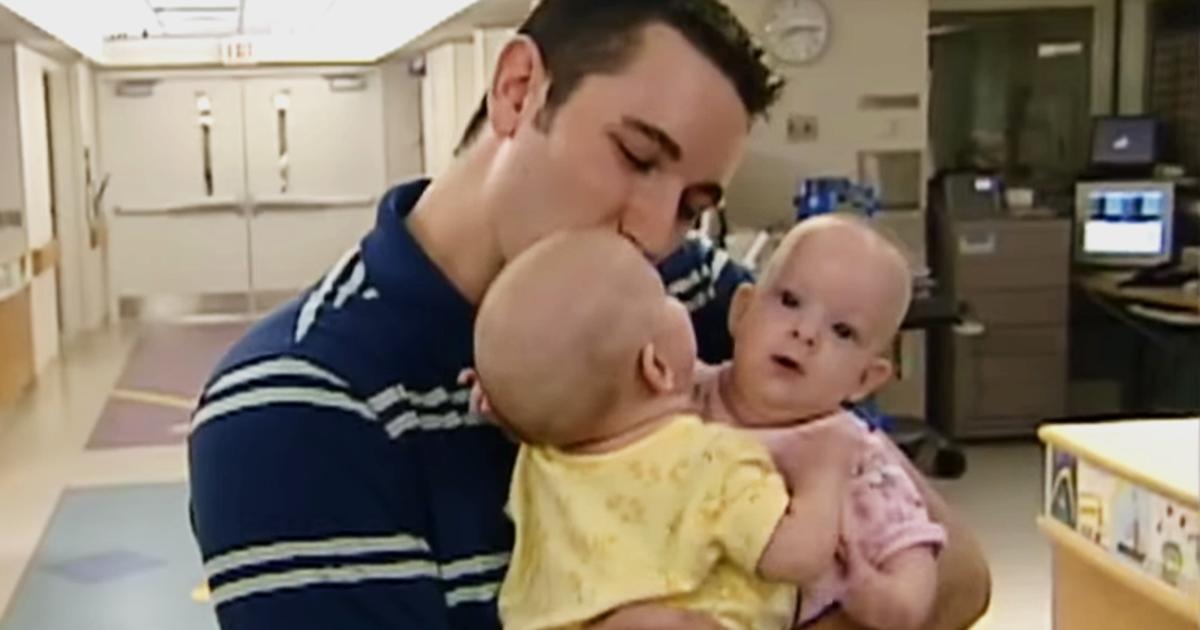 Separated as Babies, Conjoined Twins Isabelle and Abby Are Thriving as Teens Nearly 18 Years Later