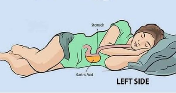Health Benefits of Sleeping on Your Left Side